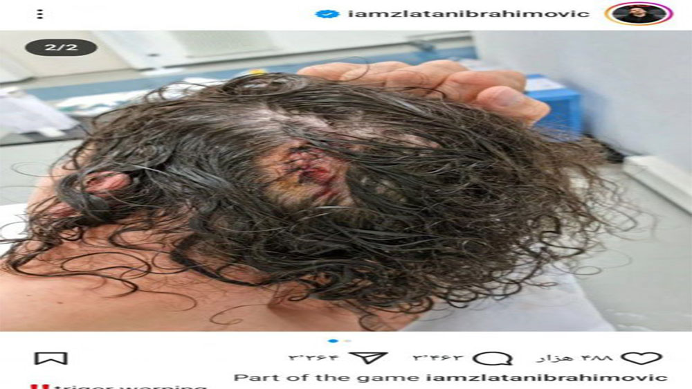 یادگاری تلخ مسابقات رزمی روی سر زلاتان! (عکس) - حاشیه های فوتبالی یادگاری تلخ مسابقات رزمی روی سر زلاتان! (عکس)