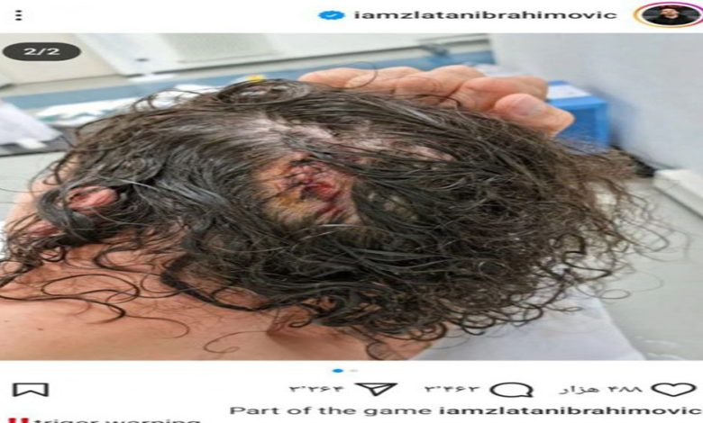 یادگاری تلخ مسابقات رزمی‌ روی سر زلاتان! (عکس)