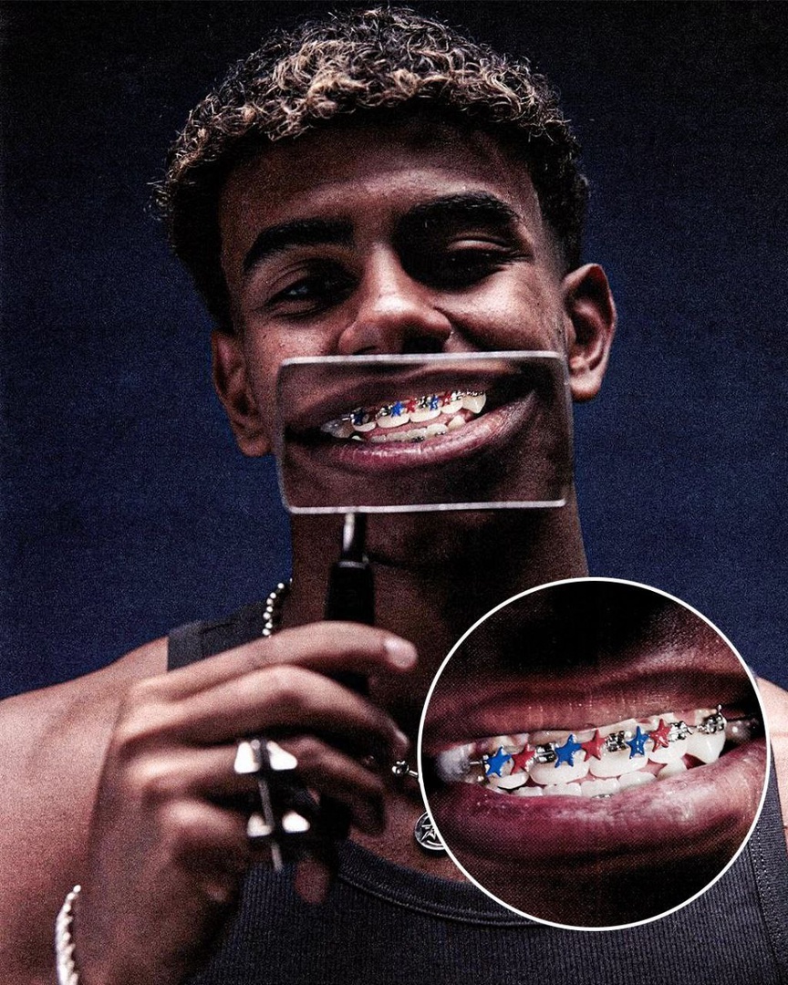 لامین یامال با ارتودنسی لامین یامال با ارتودنسی