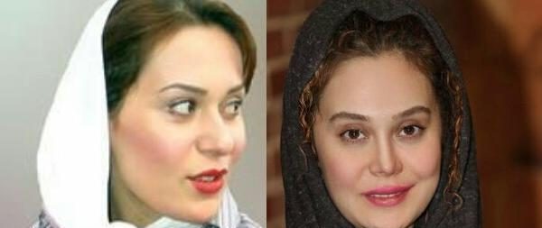 عکس قبل عمل ارام جعفری