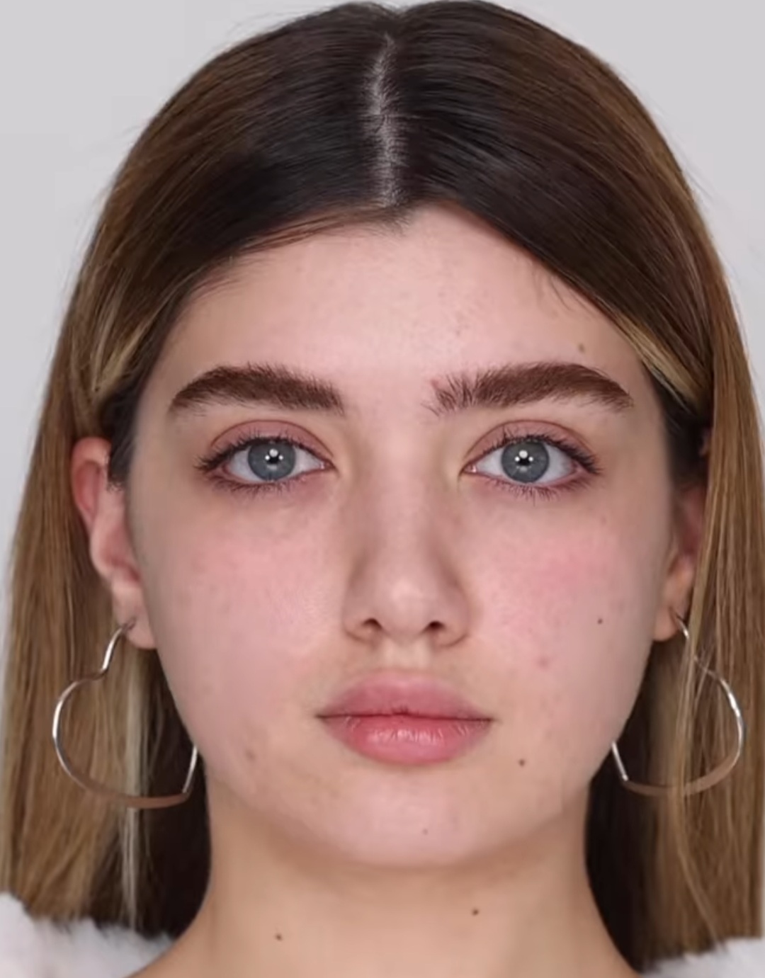 عکس نگین حق دوست قبل عمل عکس نگین حق دوست قبل عمل