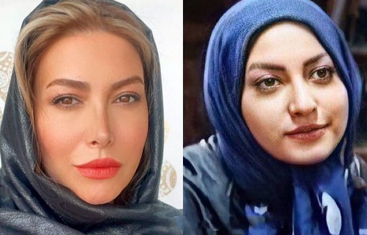عکس فریبا نادری بعد از عمل زیبایی عکس فریبا نادری بعد از عمل زیبایی