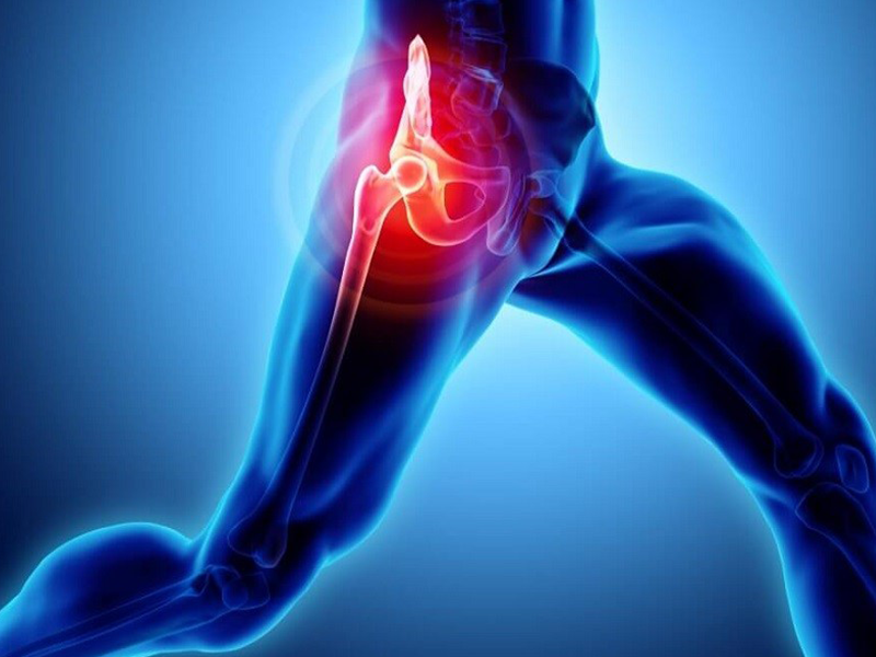 آیا پوبالژیا همان فتق ورزشی است