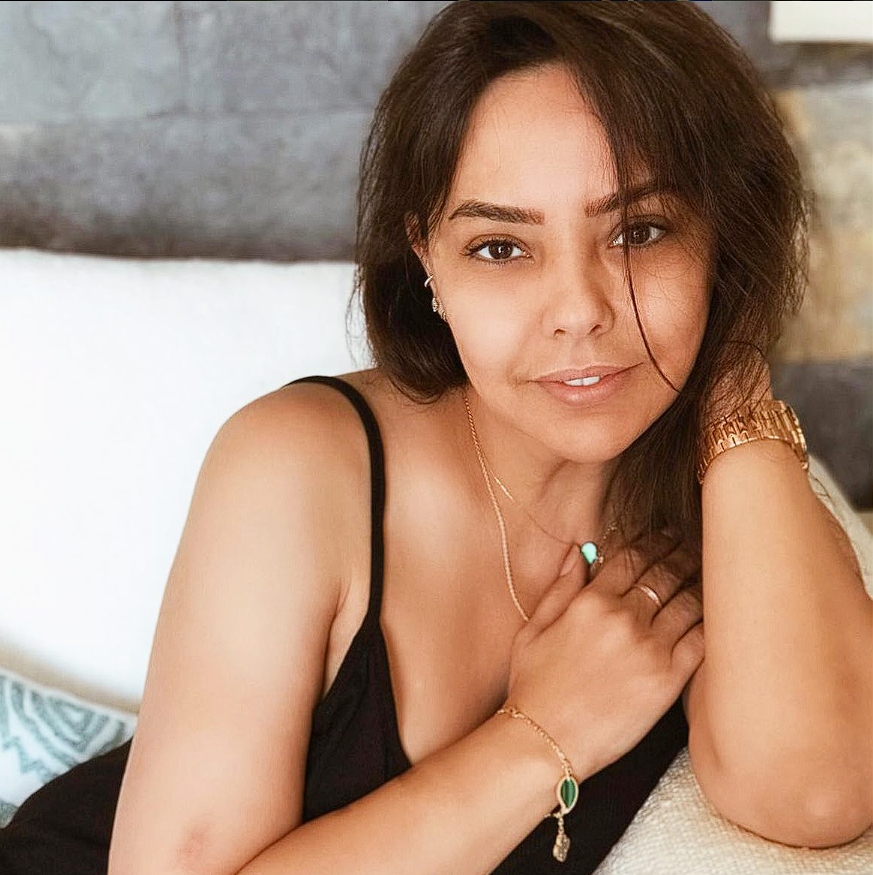 ابرو گوندش قبل عمل